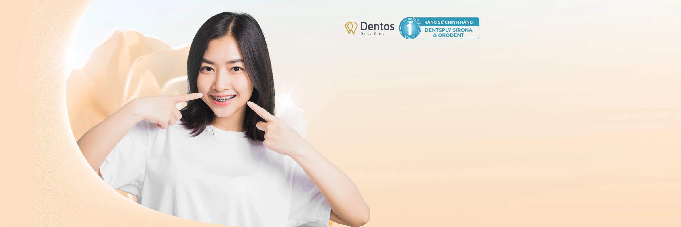 NIỀNG RĂNG THẨM MỸ