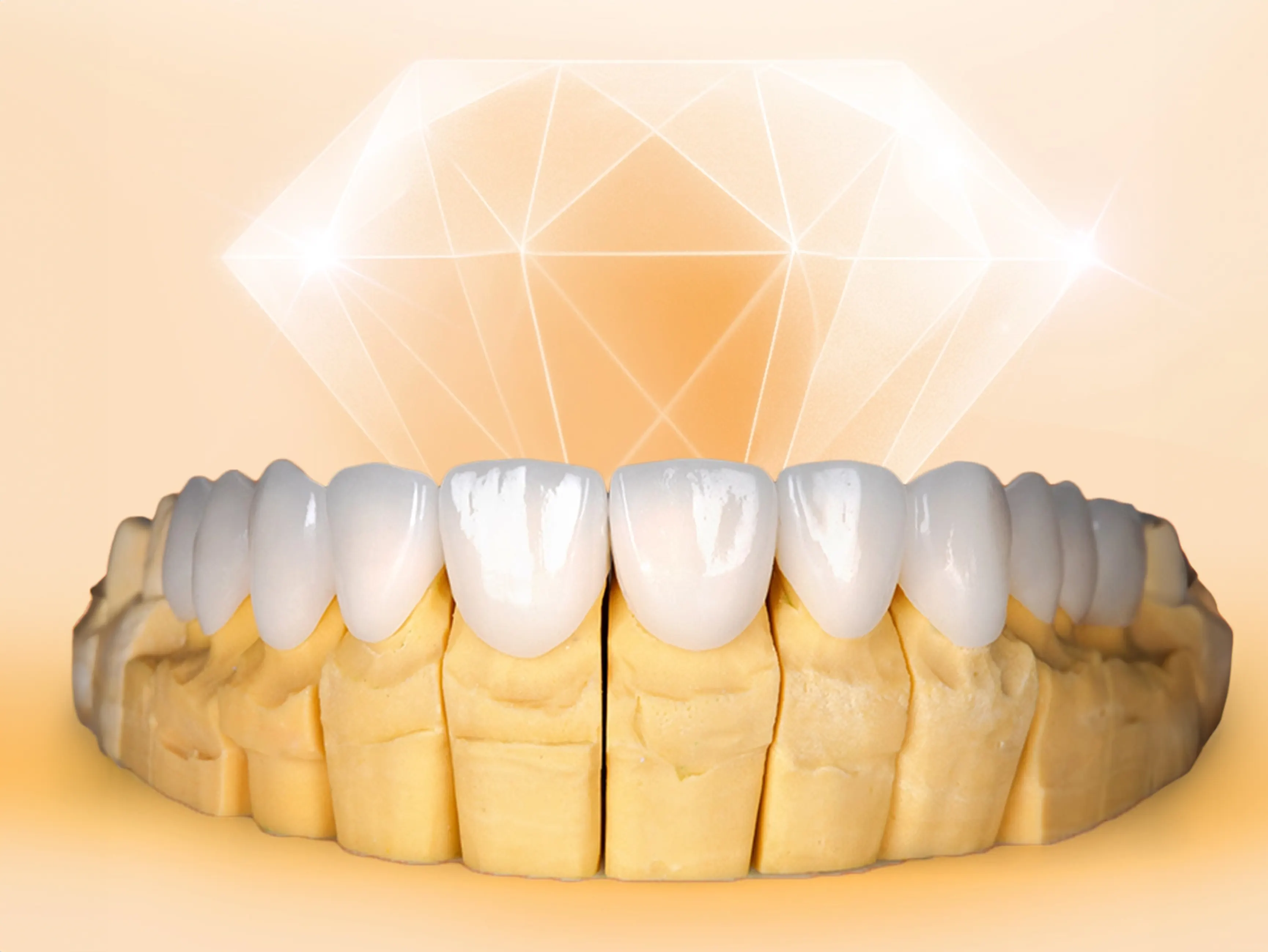 Răng Sứ DDBio Phù Hợp Với Ai?