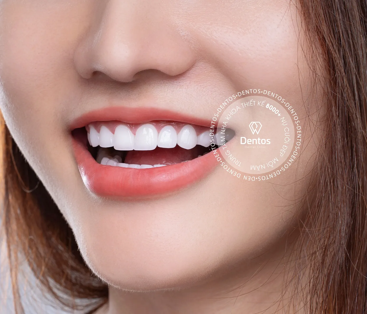 Bật mí địa chỉ bọc răng sứ tốt tại TP.HCM
