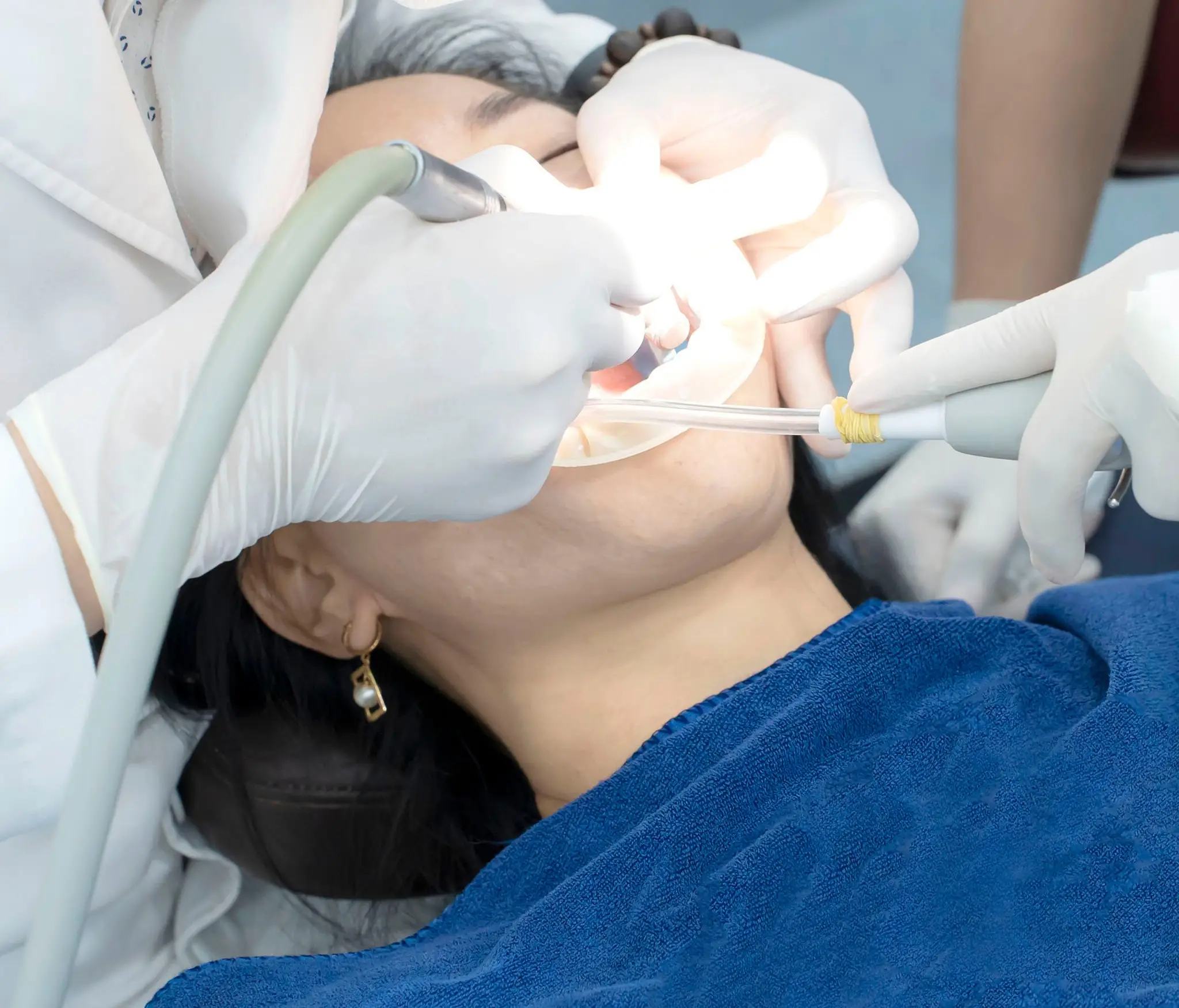 Bọc răng sứ có đau không? Giải đáp chi tiết mọi lo lắng của bạn