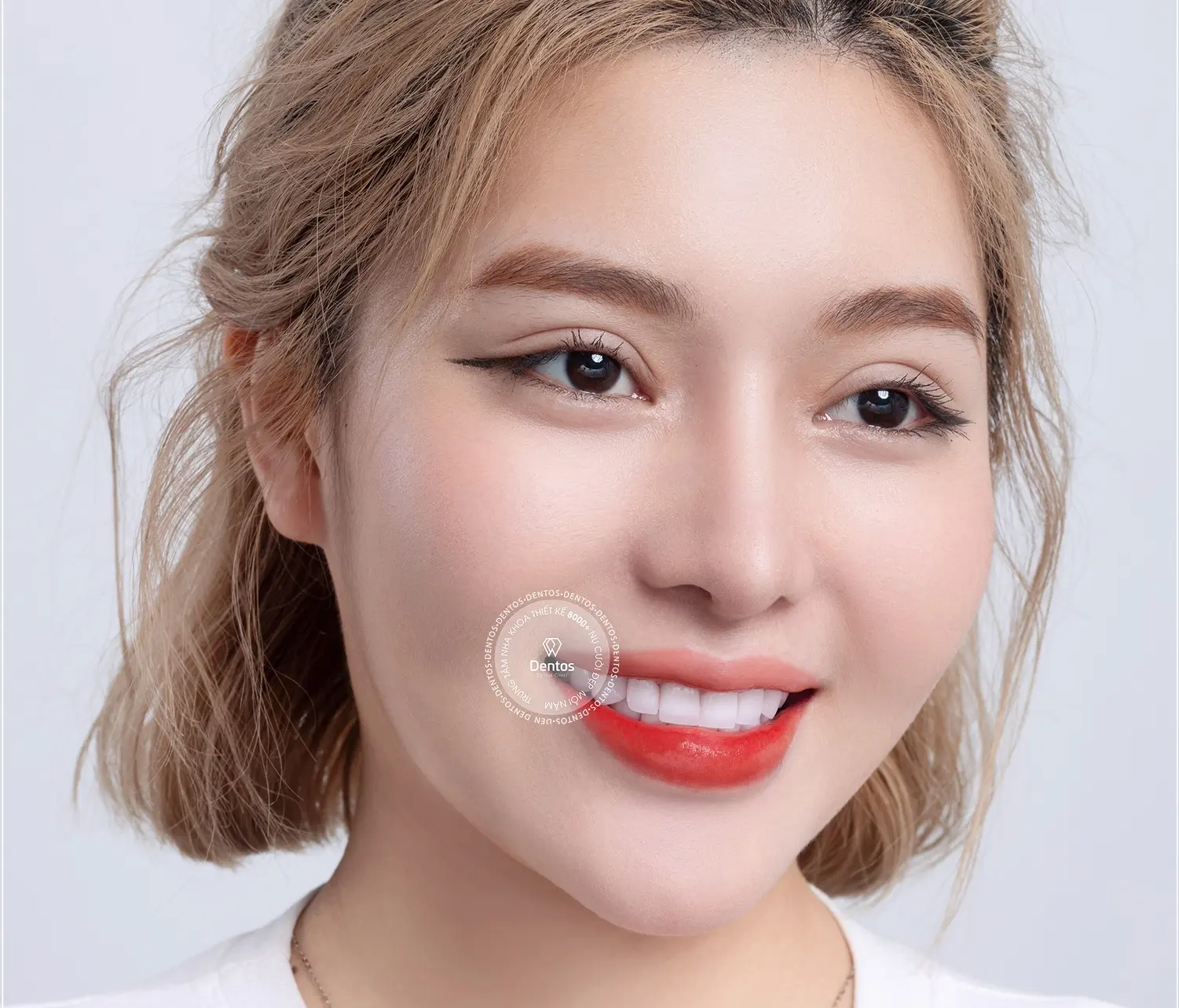 Răng sứ loại nào tốt nhất? So sánh ưu nhược điểm từng loại