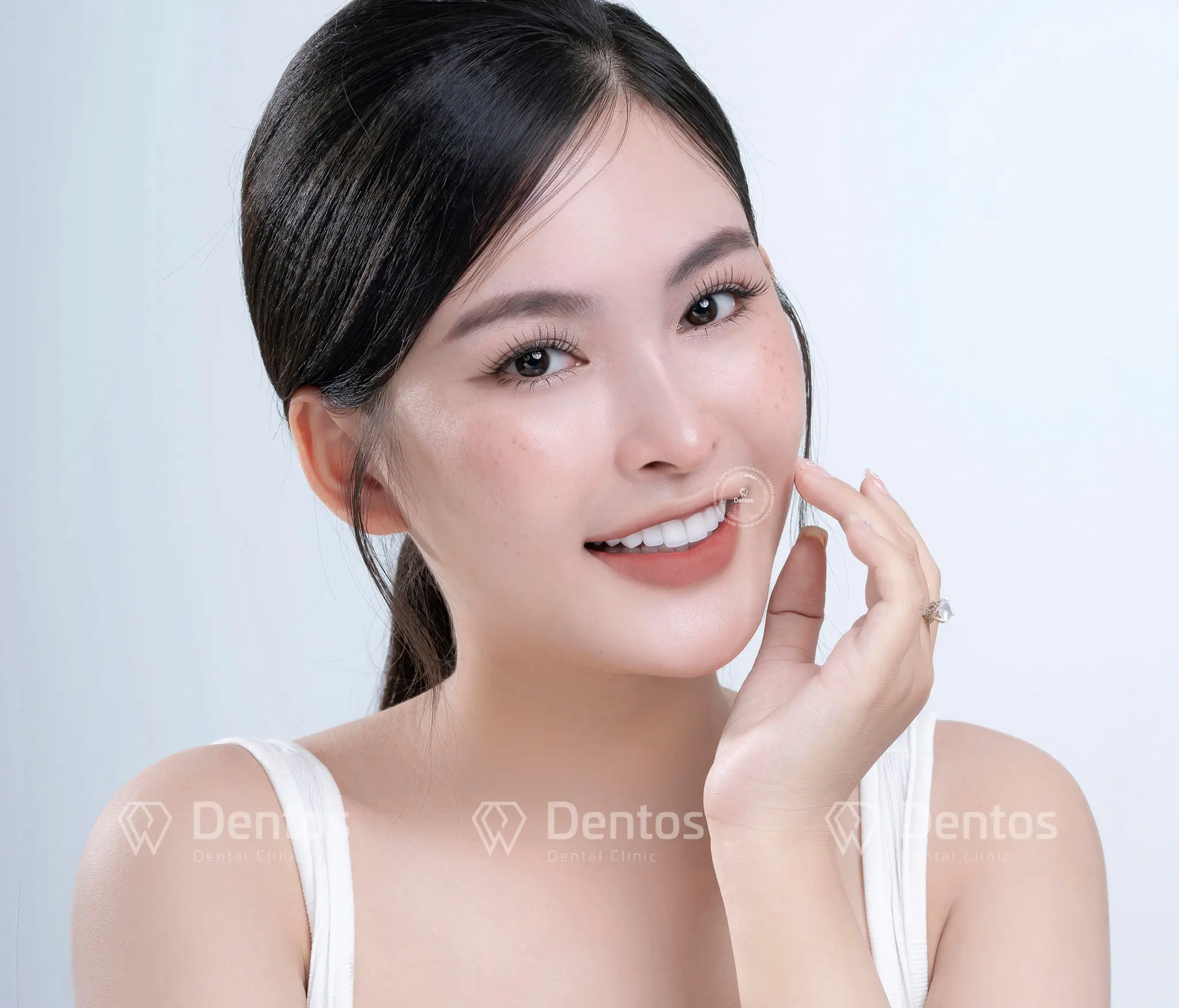 Bọc răng sứ cho răng móm có được không?