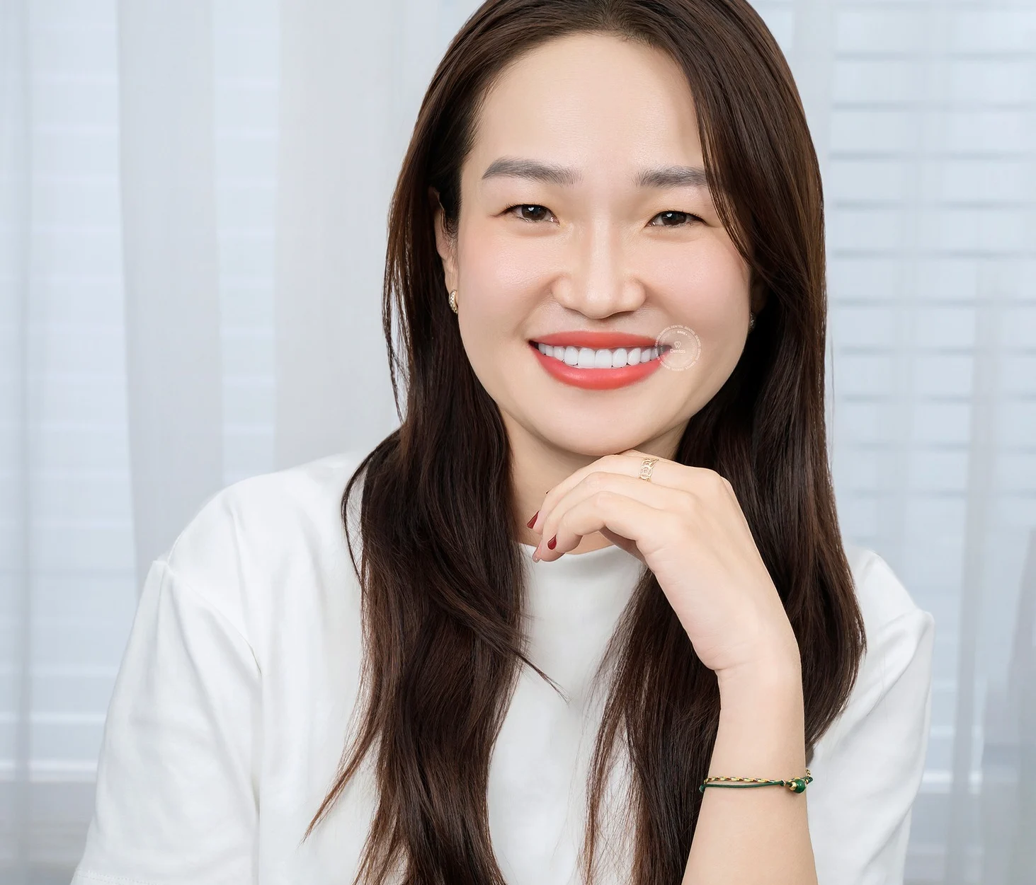 Răng sứ Cercon của nước nào? Dùng có tốt không?
