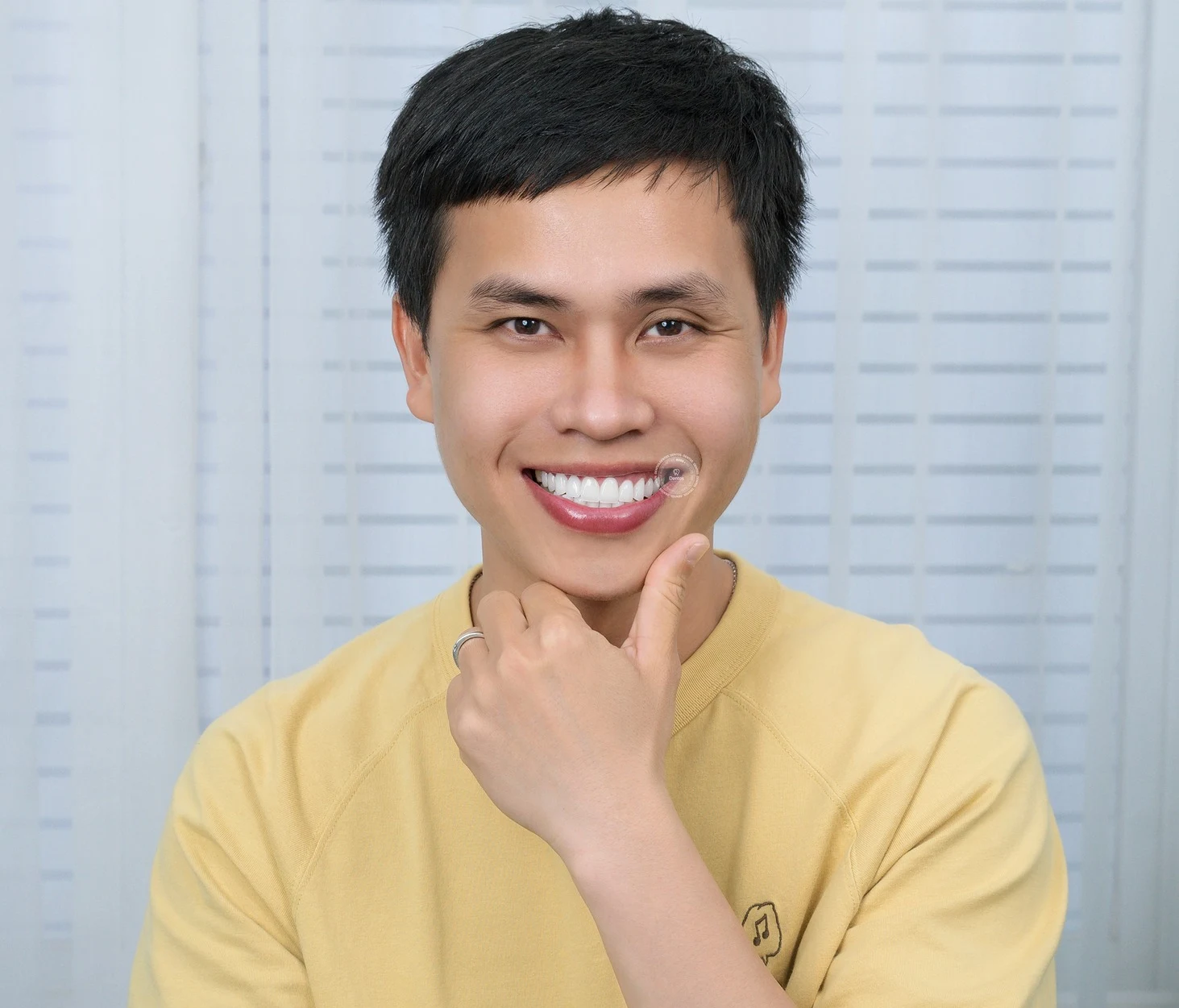 Răng sứ bị lung lay là do đâu? Cách khắc phục?