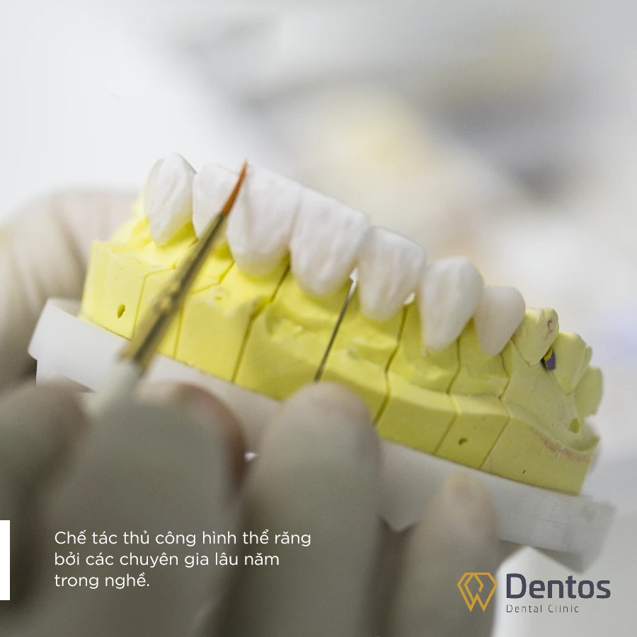 Nha khoa Dentos có Labo chế tác răng sứ tại chỗ hiện đại
