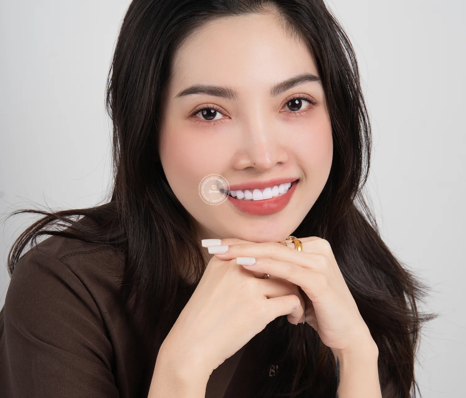Mão răng sứ phục hồi chức năng ăn nhai và thẩm mỹ