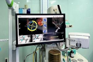 Công nghệ X-GUIDE mang đến khả năng điều hướng 3D động, tăng tỉ lệ chính xác khi đặt implant