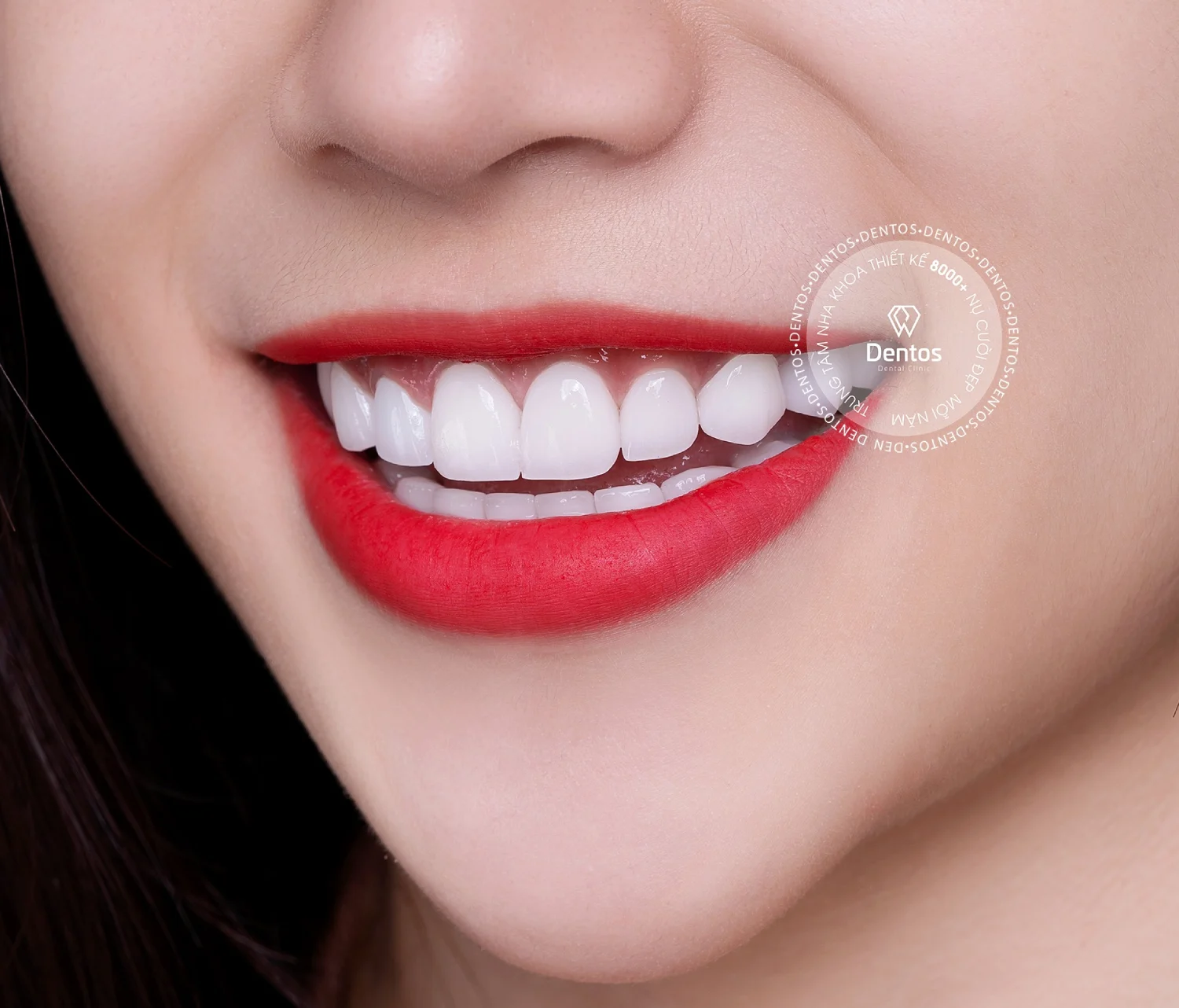 Nha khoa Dentos có 4 loại răng sứ Đức được cung cấp, bao gồm Zirconia, HT Smile, DDBio, và Cercon HT.