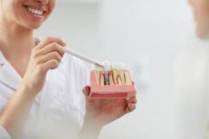 Bệnh nhân bị mất răng, hư hỏng có thể tham khảo phương pháp cấy implant