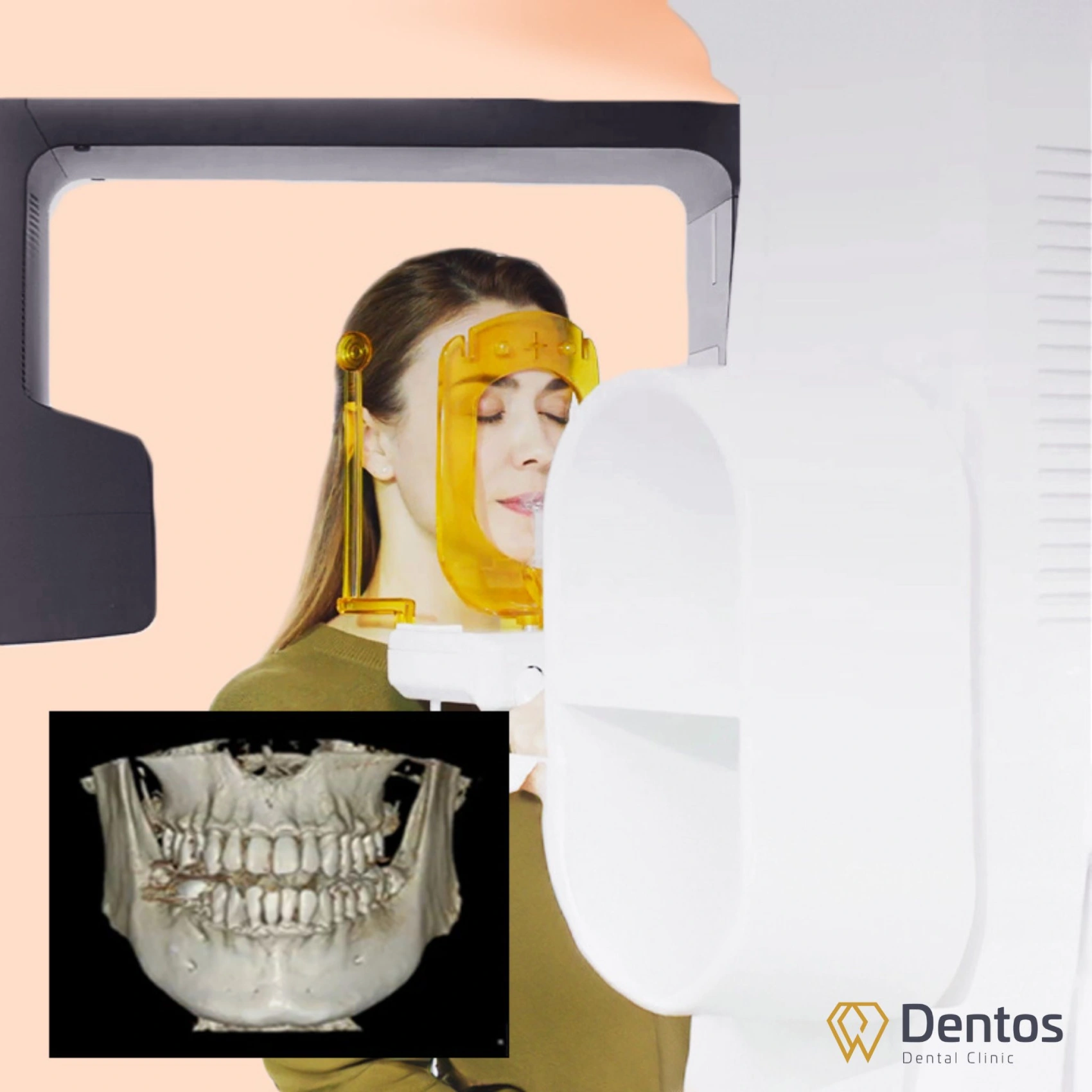 Công nghệ CT Cone Beam 3D hiện đại hỗ trợ bác sĩ chẩn đoán chính xác