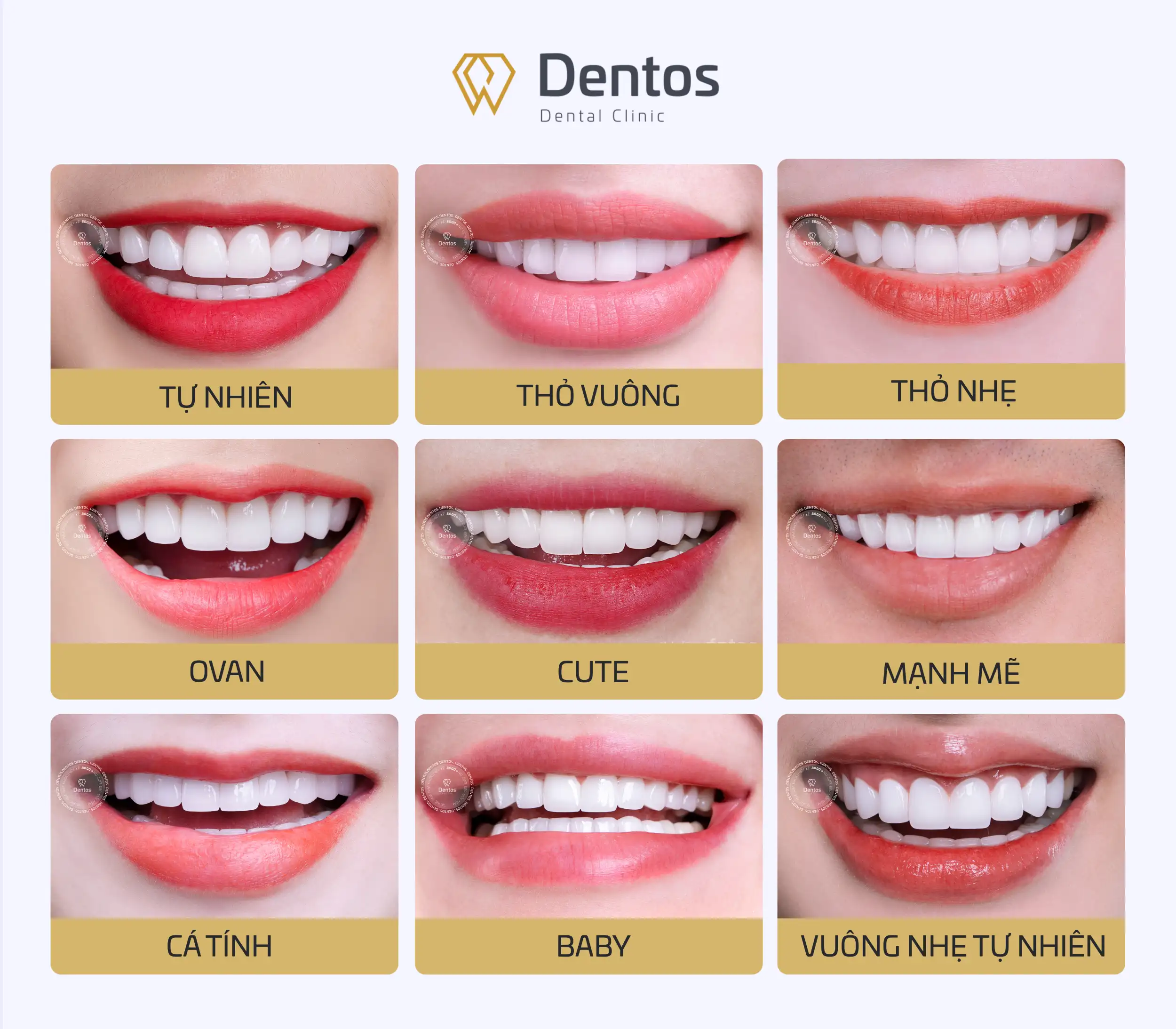 9 dáng răng Zirconia được sử dụng phổ biến