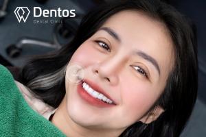 Dentos – Hệ thống nha khoa thẩm mỹ hàng đầu Sài Gòn