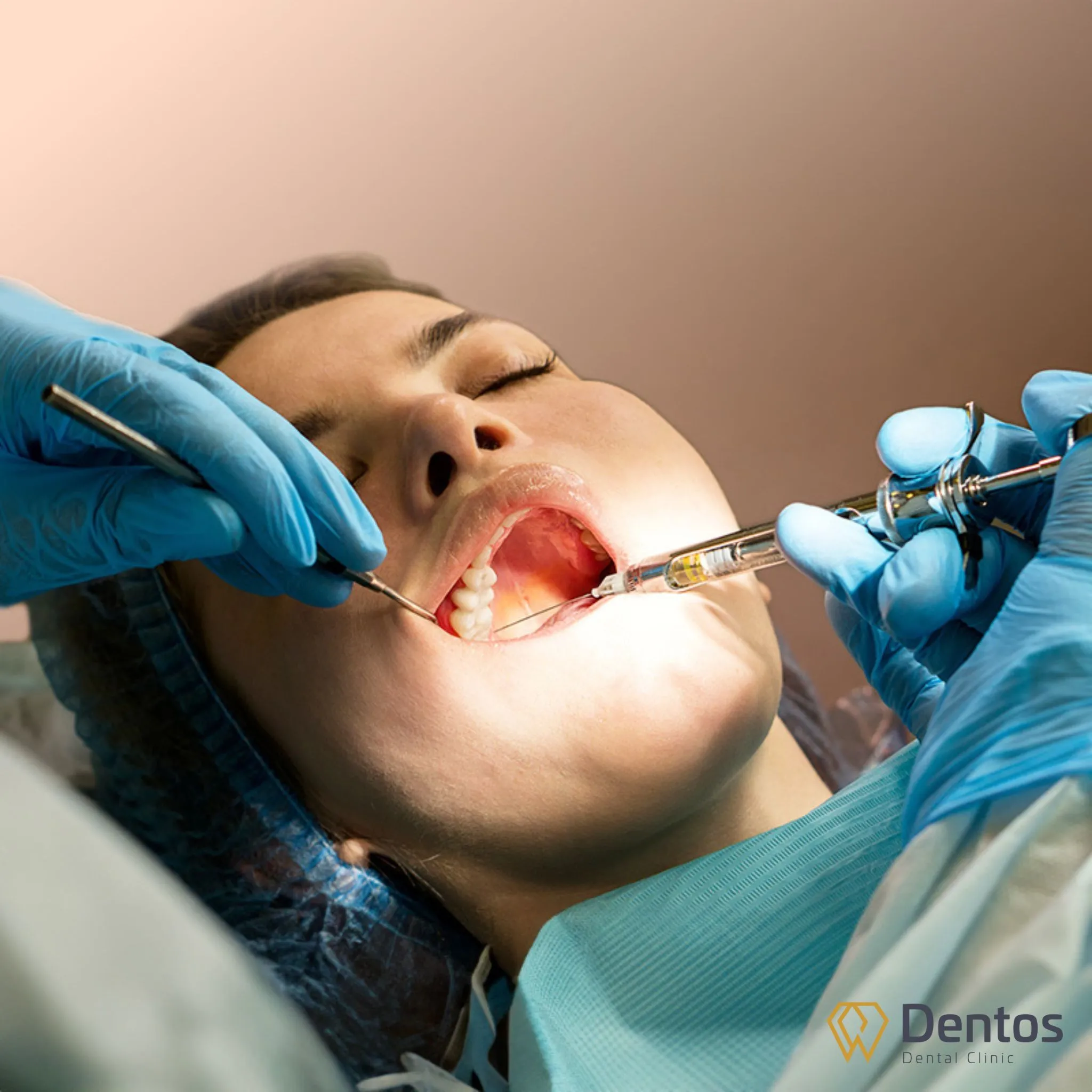Răng bọc sứ bị đau là điều hiển nhiên nếu răng sâu, viêm tủy mà không được xử lý hoàn toàn