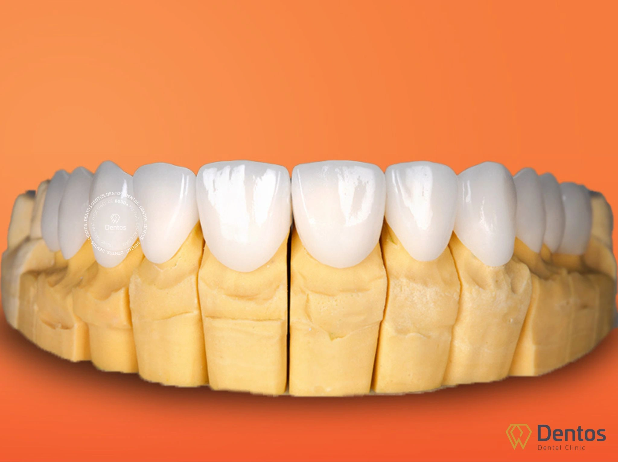 Nha khoa Dentos nhập khẩu chính hãng duy nhất 1 sản phẩm răng sứ DDBio