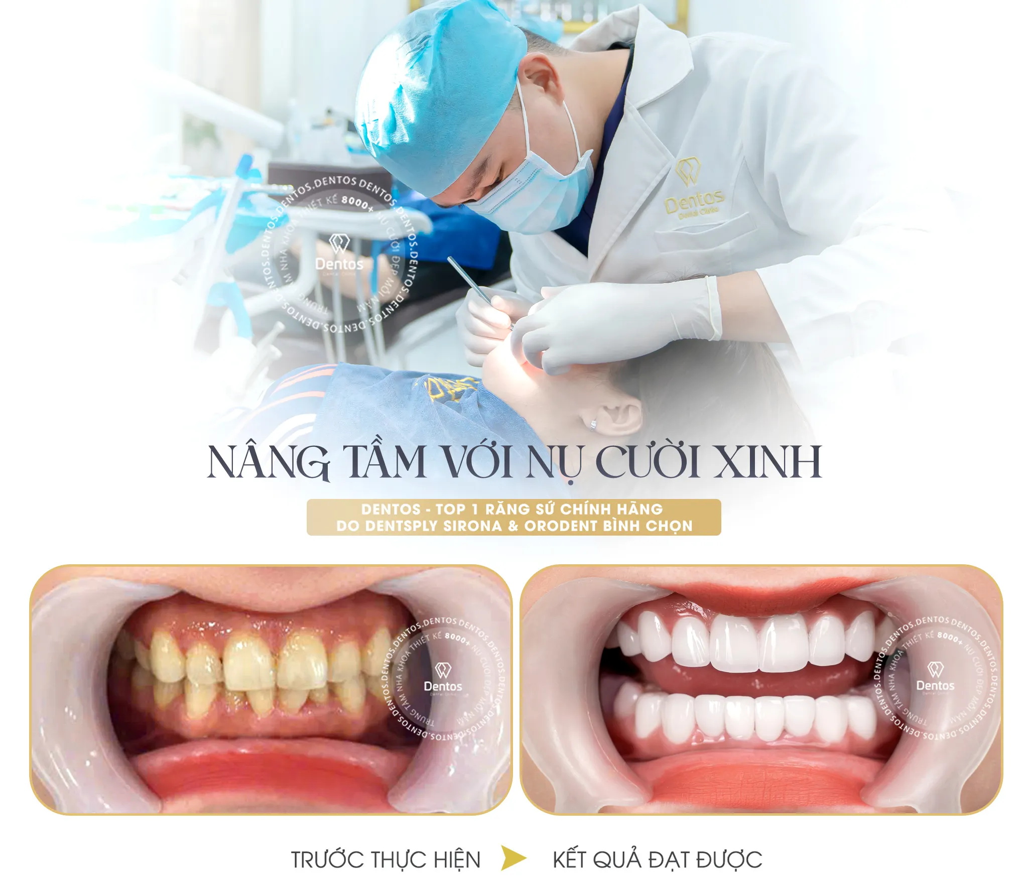 Nha khoa Dentos tự tin mang đến cho bạn nụ cười khỏe đẹp trọn đời