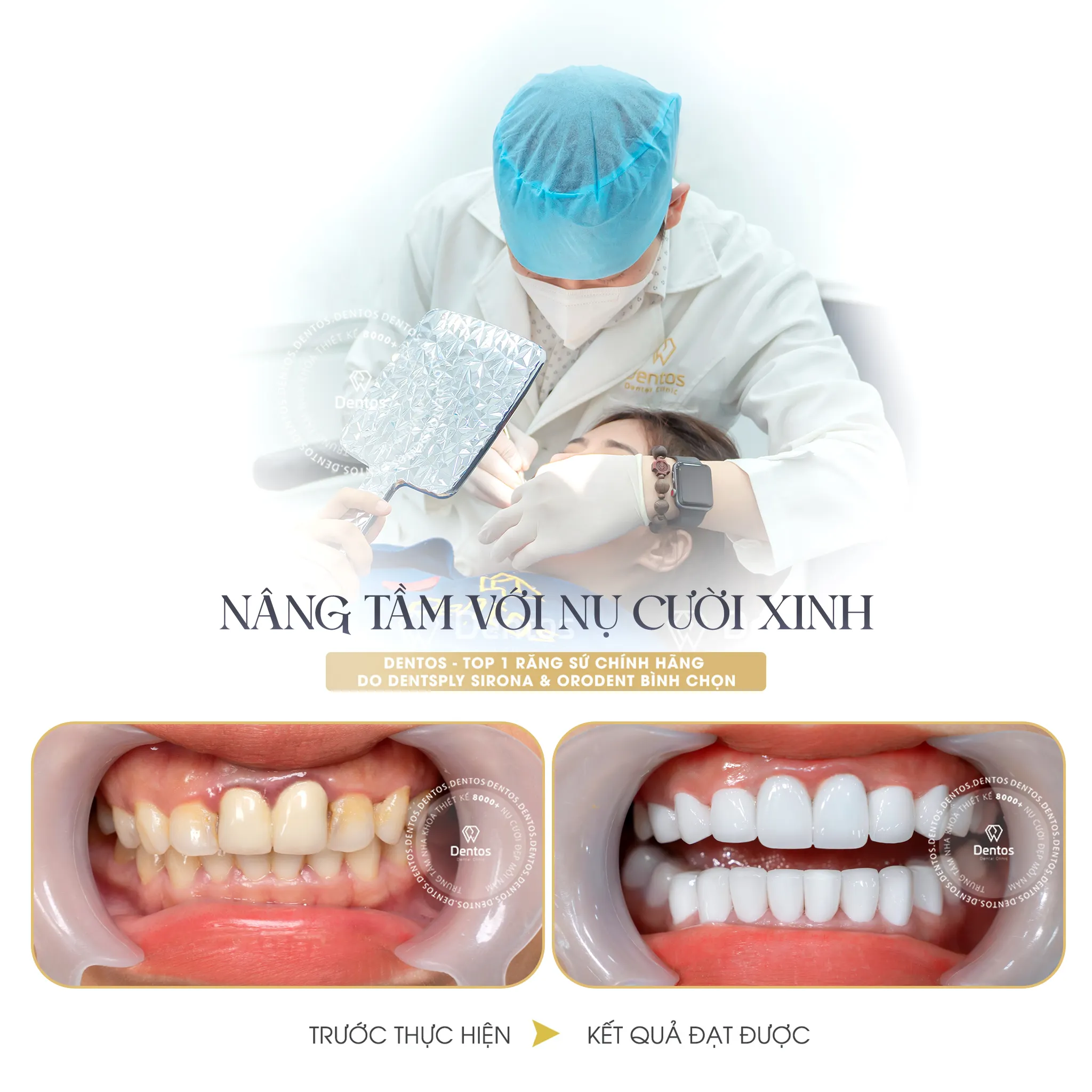 Nha khoa Dentos tự tin mang đến cho bạn hàm răng đẹp tự nhiên với mức giá hợp lý