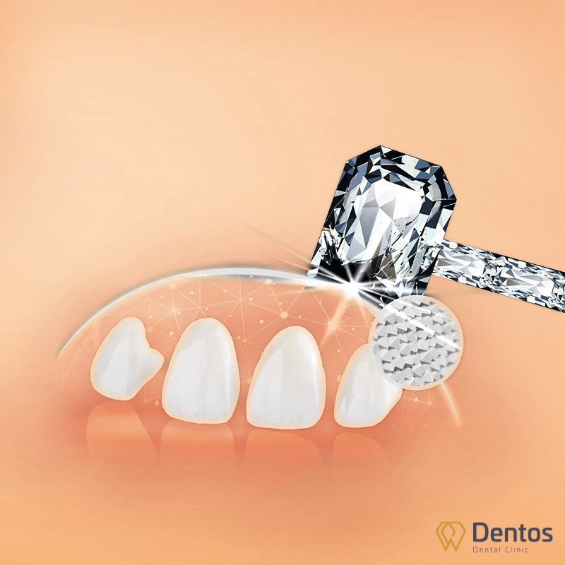 Răng sứ Orodent có độ bền lên tới 2000 Mpa, cao gấp 7 - 10 lần răng thật