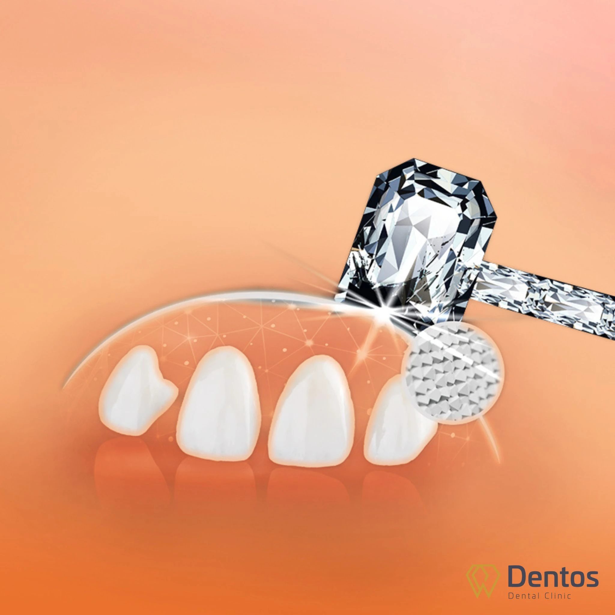 Răng sứ DDBio có độ cứng gấp 4 lần răng thật