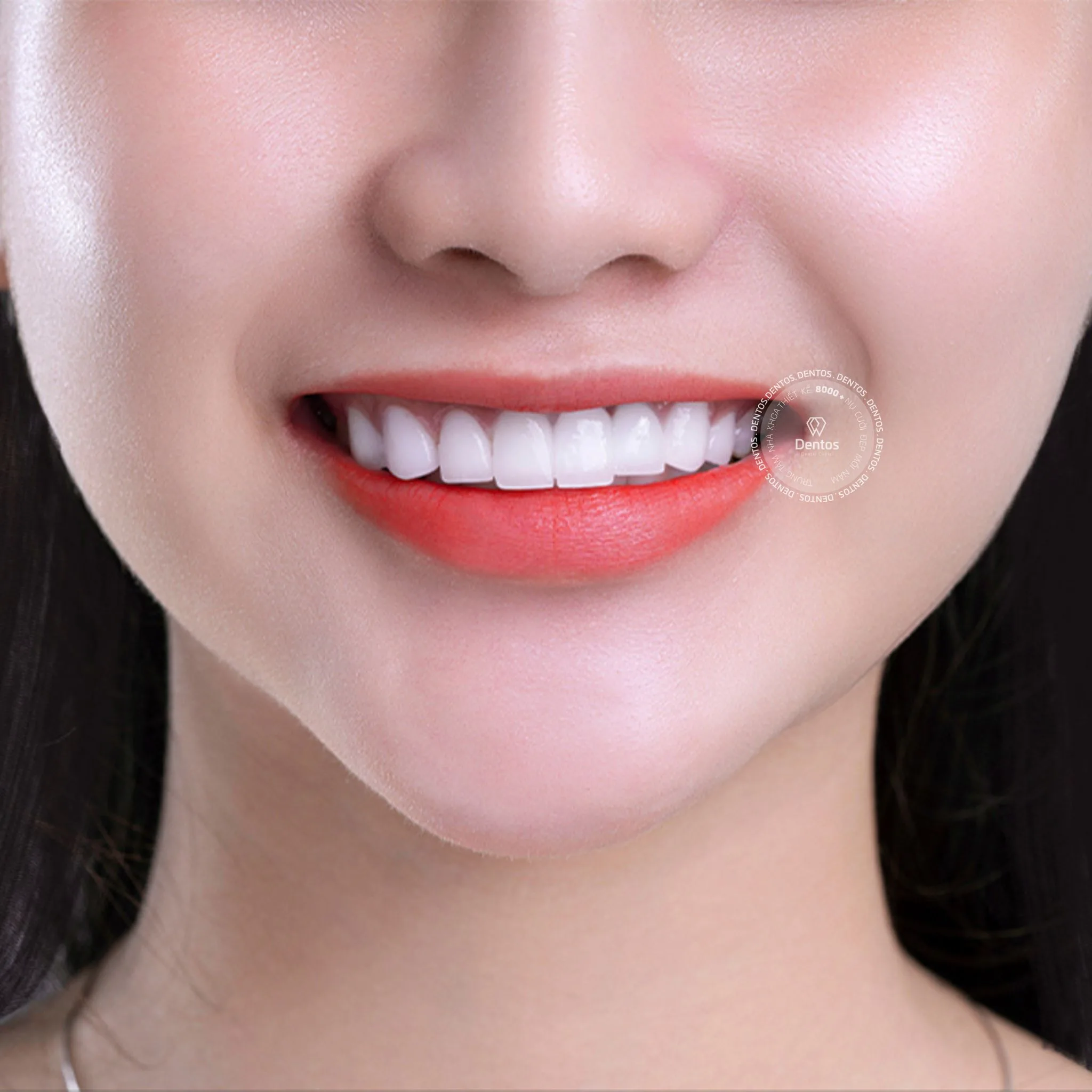 Răng toàn sứ có độ trong mờ, màu sắc, vân răng và khả năng phản quang như răng thật