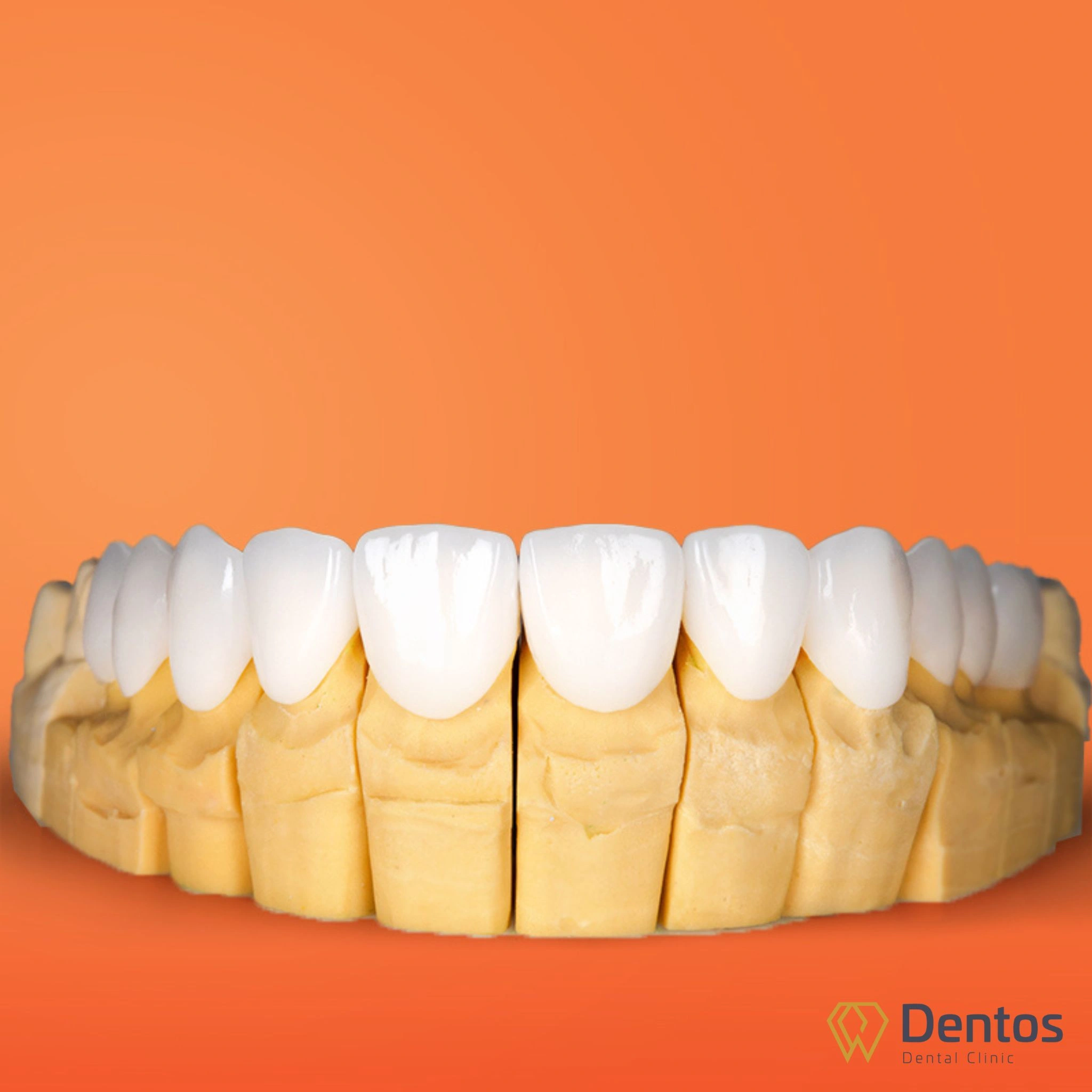 Răng sứ Zirconia là dòng răng toàn sứ được đúc nguyên khối từ khối sứ Zirconia