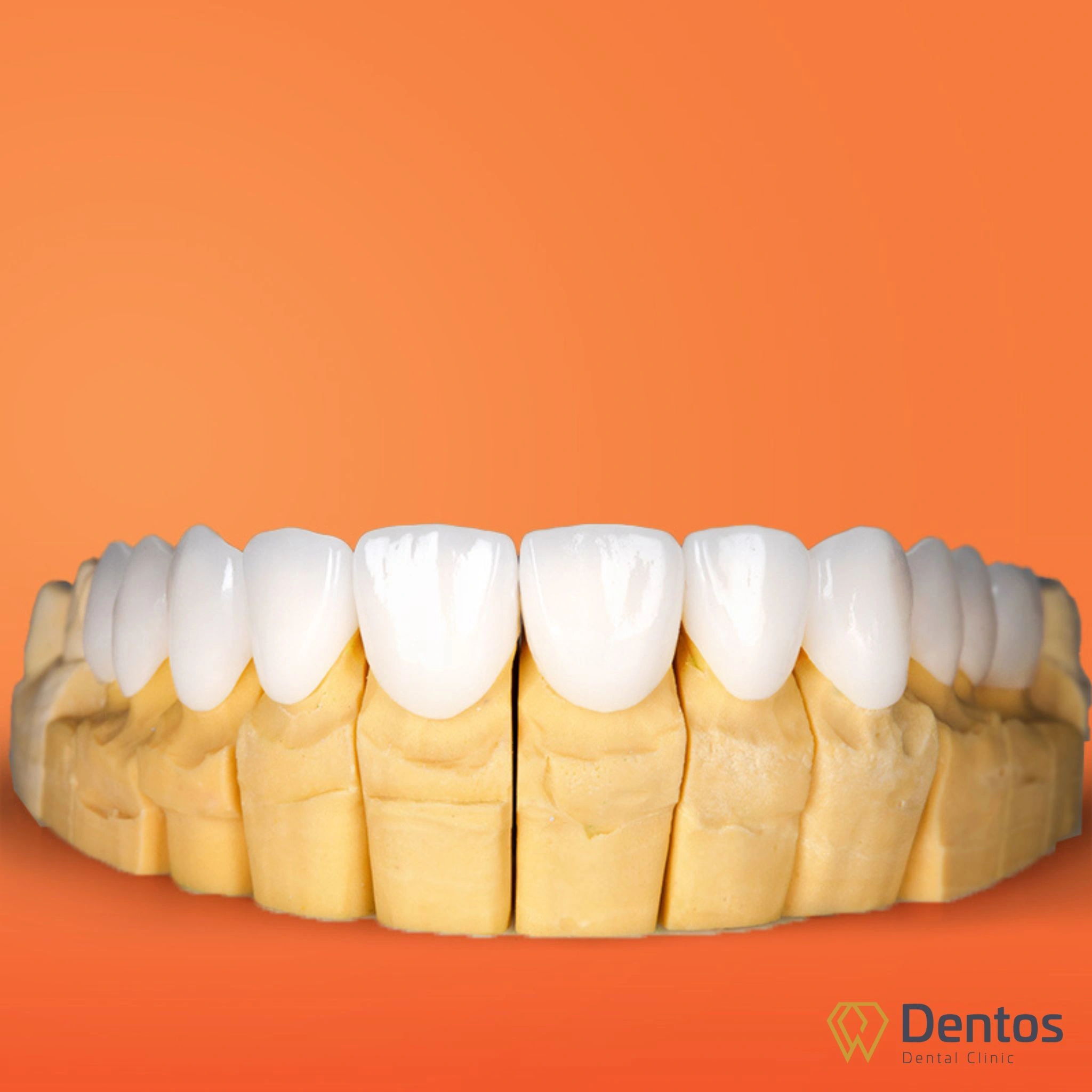 Răng sứ Zirconia HT sở hữu 2 lớp trắng ngà trong mờ đem đến màu răng tự nhiên