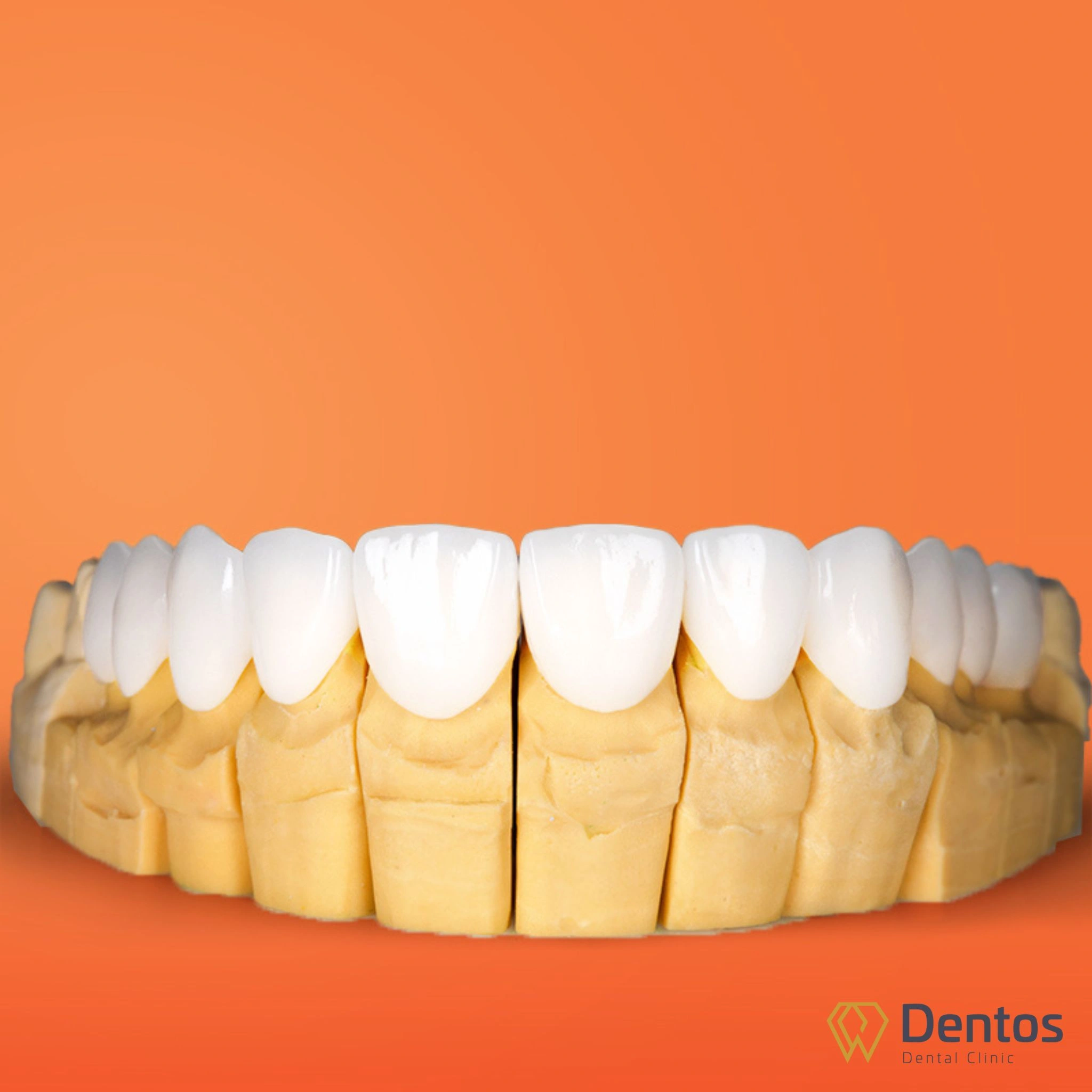 Răng sứ Zirconia được chế tác hoàn toàn từ Zirconium Dioxide (ZrO₂)