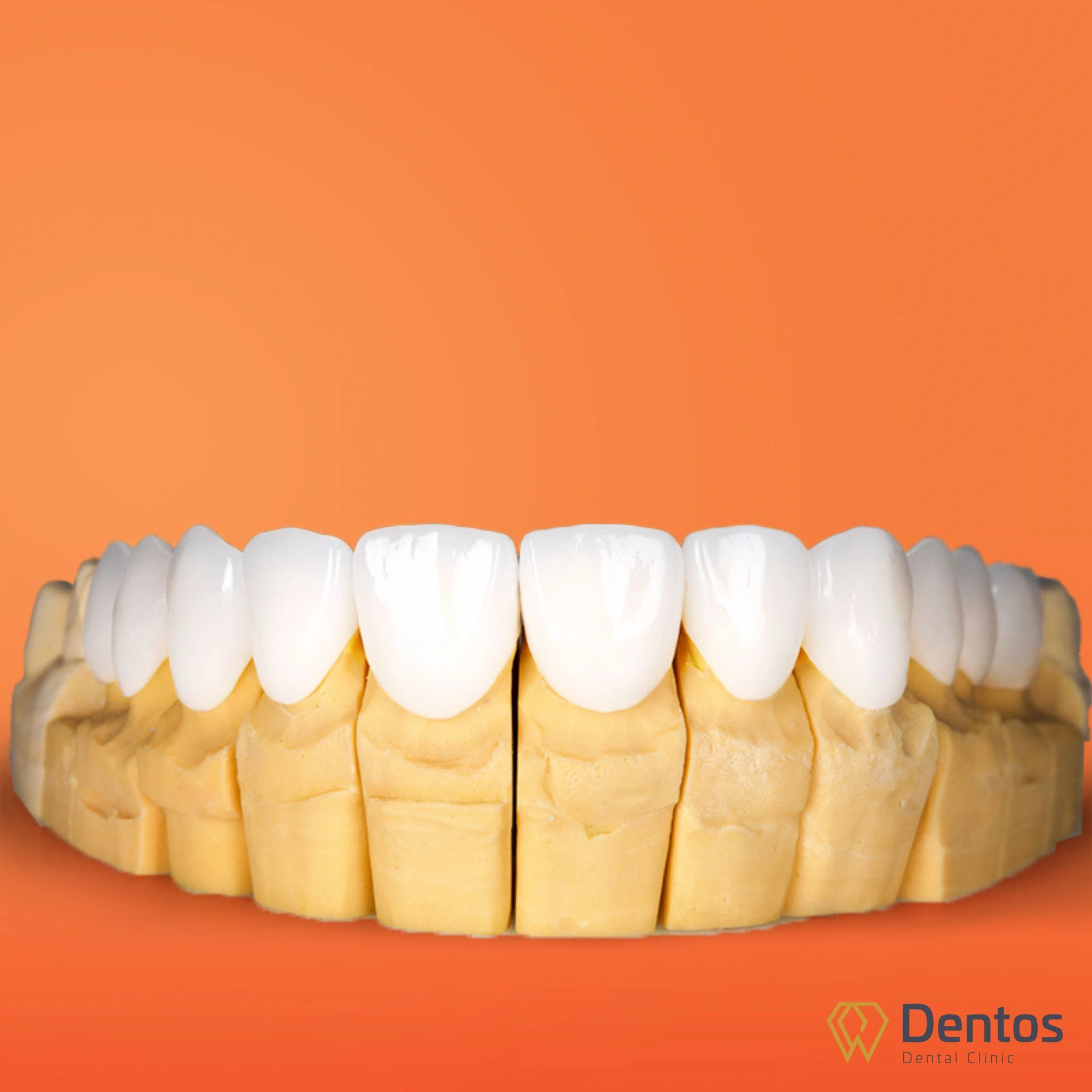 Răng sứ Zirconia chất lượng có màu sắc trắng sáng tự nhiên