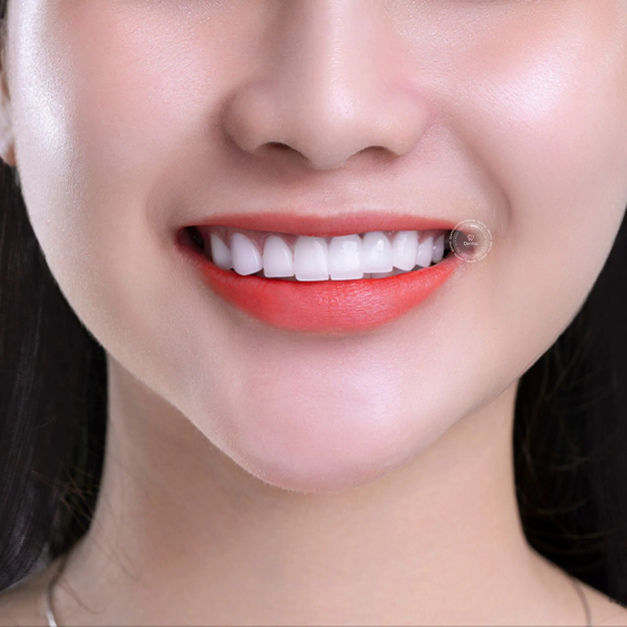Răng sứ Zirconia có cấu tạo 100% từ sứ