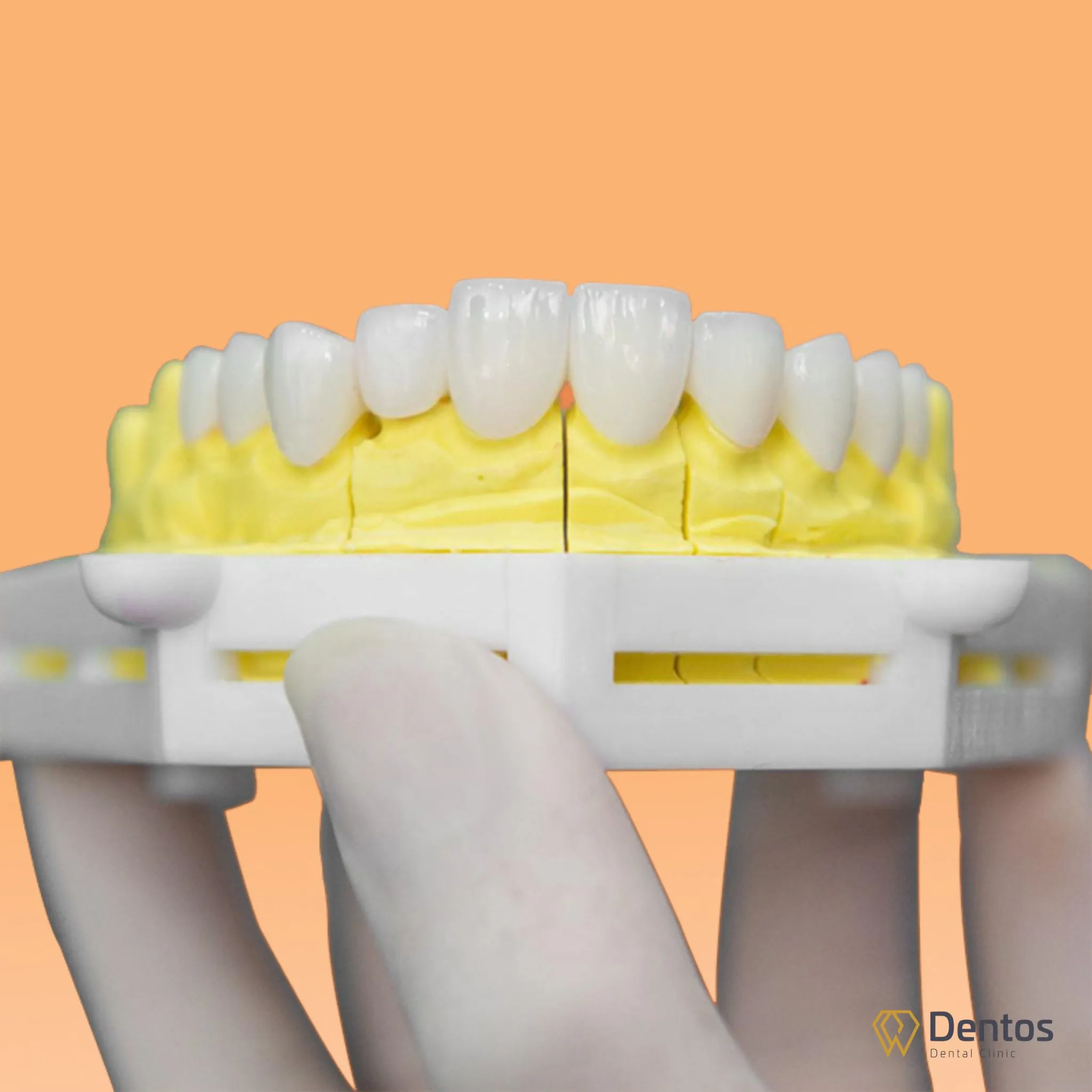 Tùy vào vị trí mà bạn chọn loại răng sứ Zirconia phù hợp