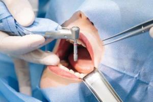 Liên hệ ngay bác sĩ nha khoa để kiểm tra nếu có hiện tượng: tê bì, đau nhức ở vùng đặt Implant, răng có dấu hiệu lung lay