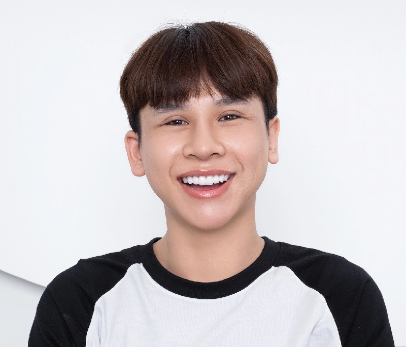 Bọc răng sứ bao lâu thì phải làm lại? Dấu hiệu răng sứ hư hỏng