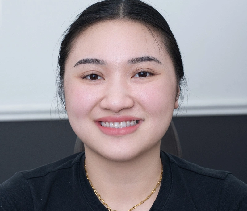 Bọc răng sứ có tháo ra được không? Nguy cơ khi tháo răng sứ