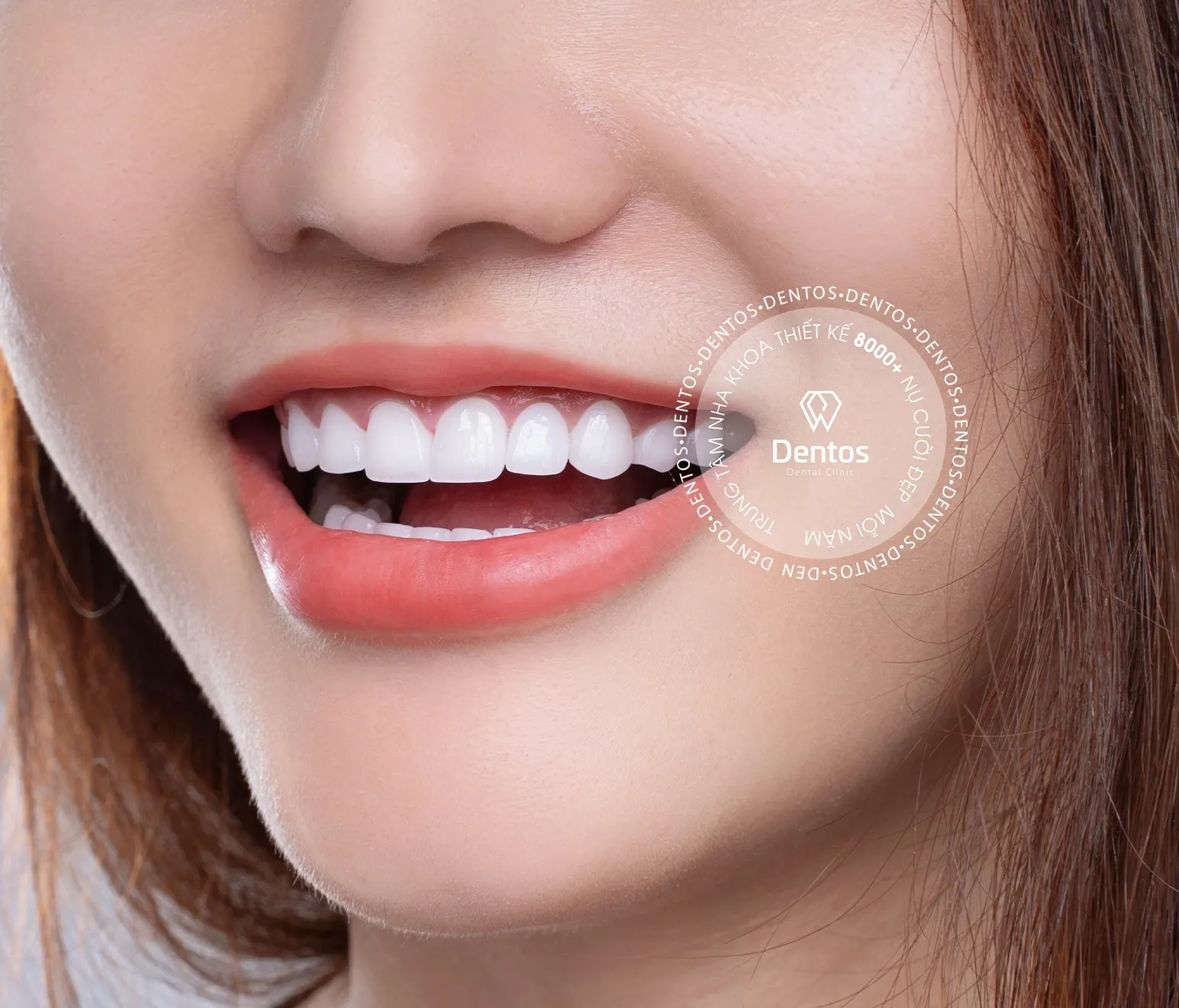 Bảng giá răng sứ mới nhất hiện nay - Có nên bọc răng sứ giá rẻ?