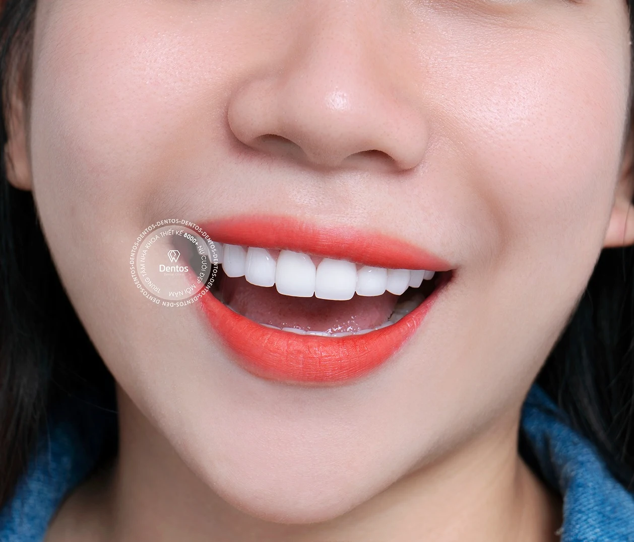 Bọc răng sứ có bền không? Cách chăm sóc để răng sứ ổn định lâu dài