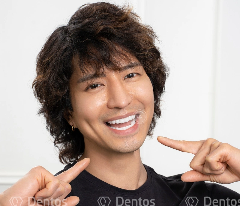 Dán sứ không mài răng có bền không? Có bảo hành không?