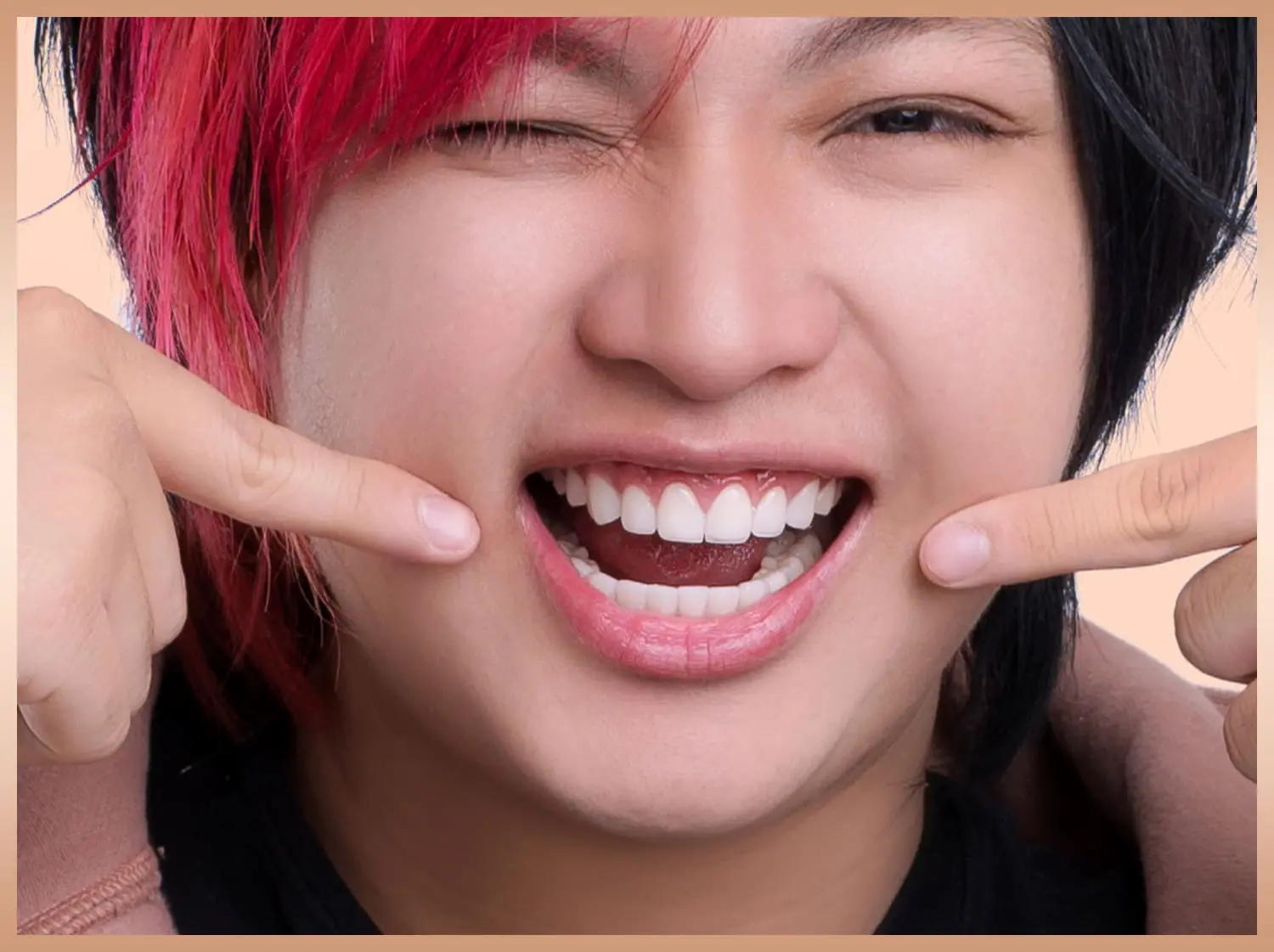 Cải thiện nụ cười với Dentos - LDP 24 triệu