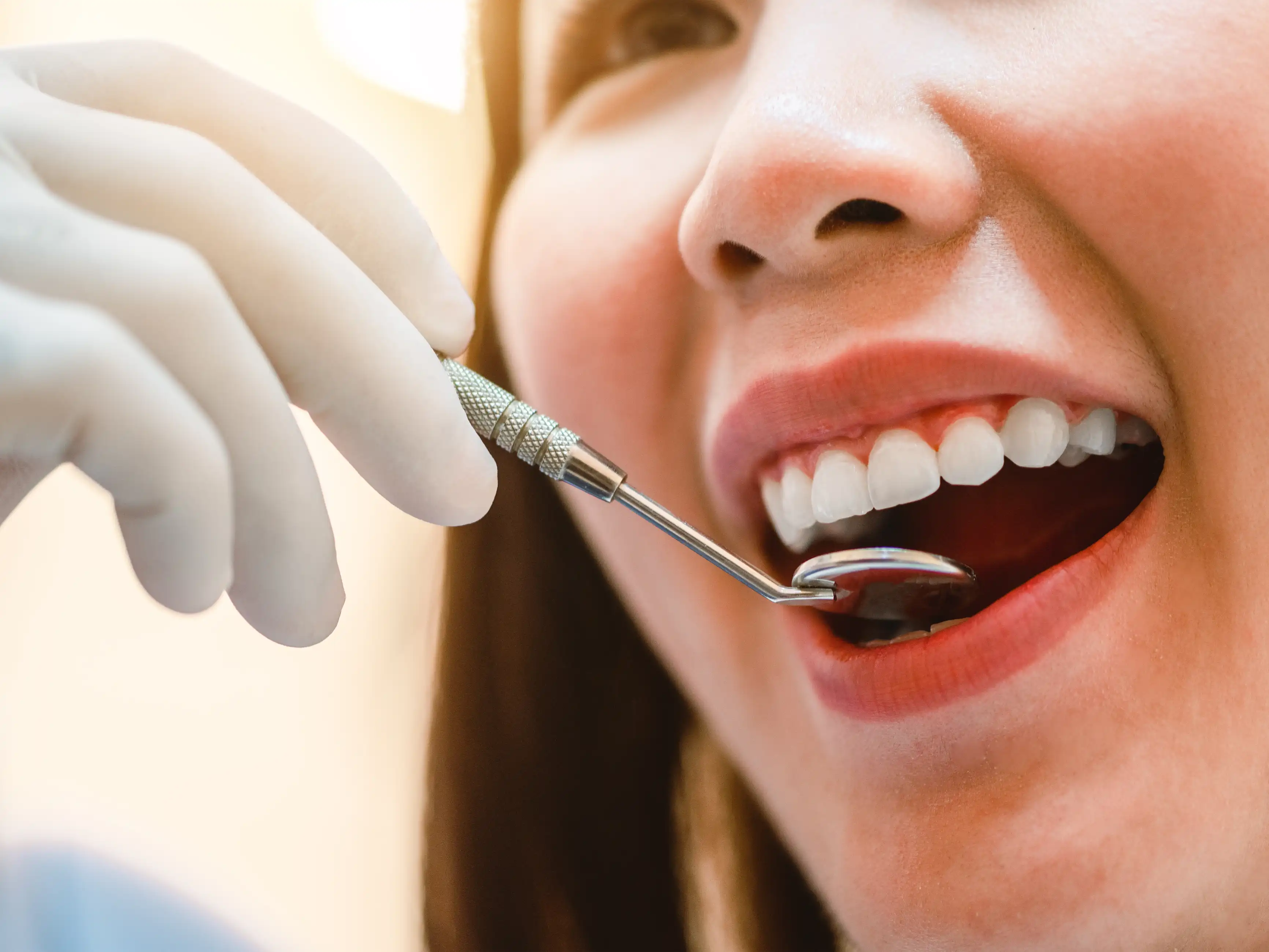 Làm Sao Để Giữ Răng Trắng Sáng Lâu Hơn?