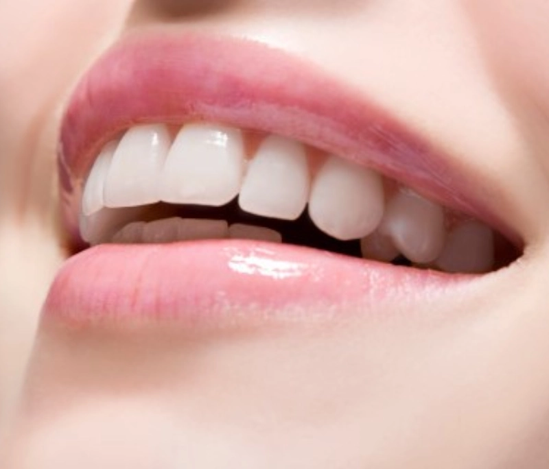 Răng sứ có bị xuống màu không? Nguyên nhân răng sứ xỉn màu