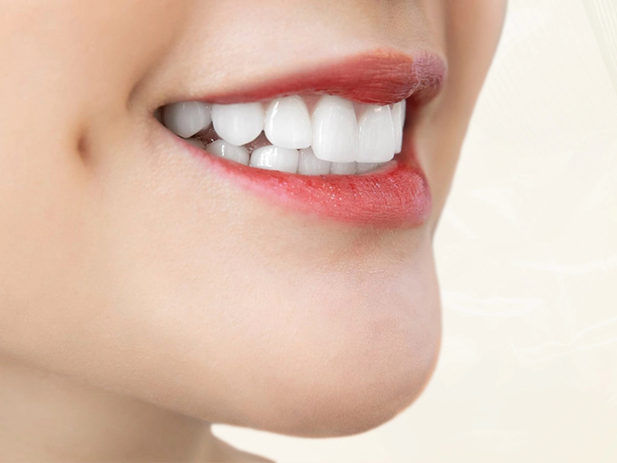 Răng Toàn Sứ DDBio - Ưu điểm 1