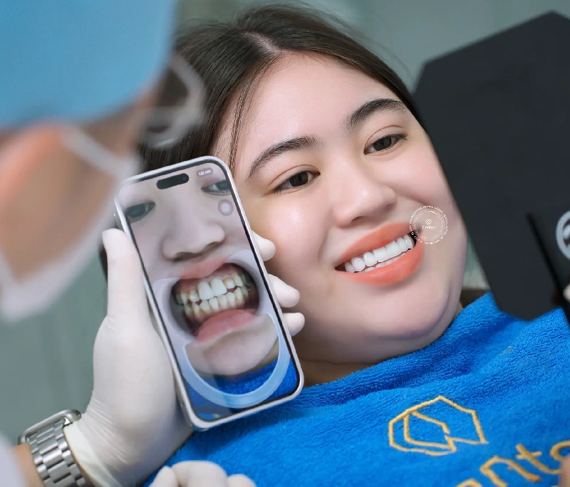 Giải đáp bọc răng sứ sau này có ảnh hưởng gì không?