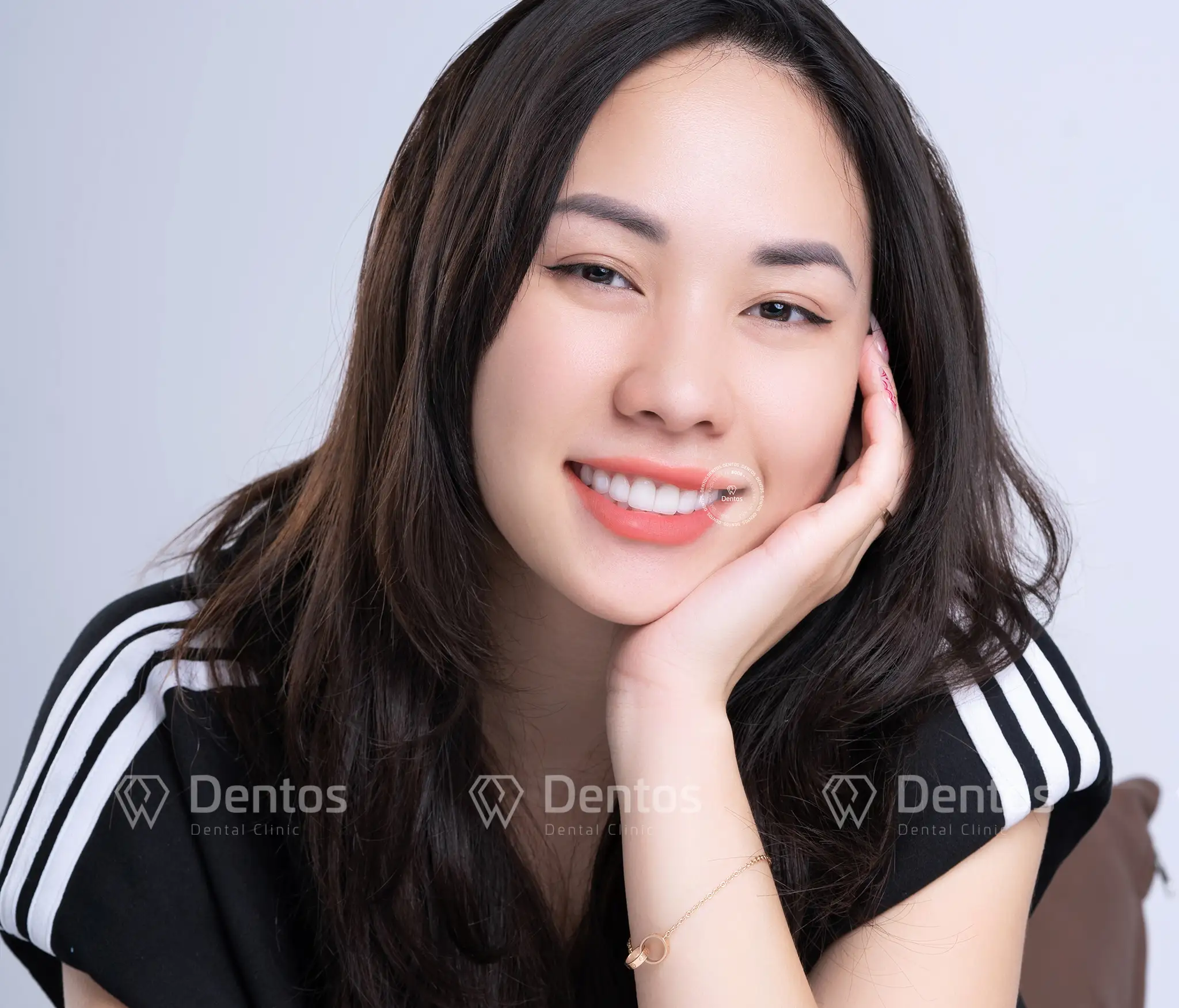 So sánh răng sứ Cercon Ht và Ht Smile - Loại nào tốt hơn?