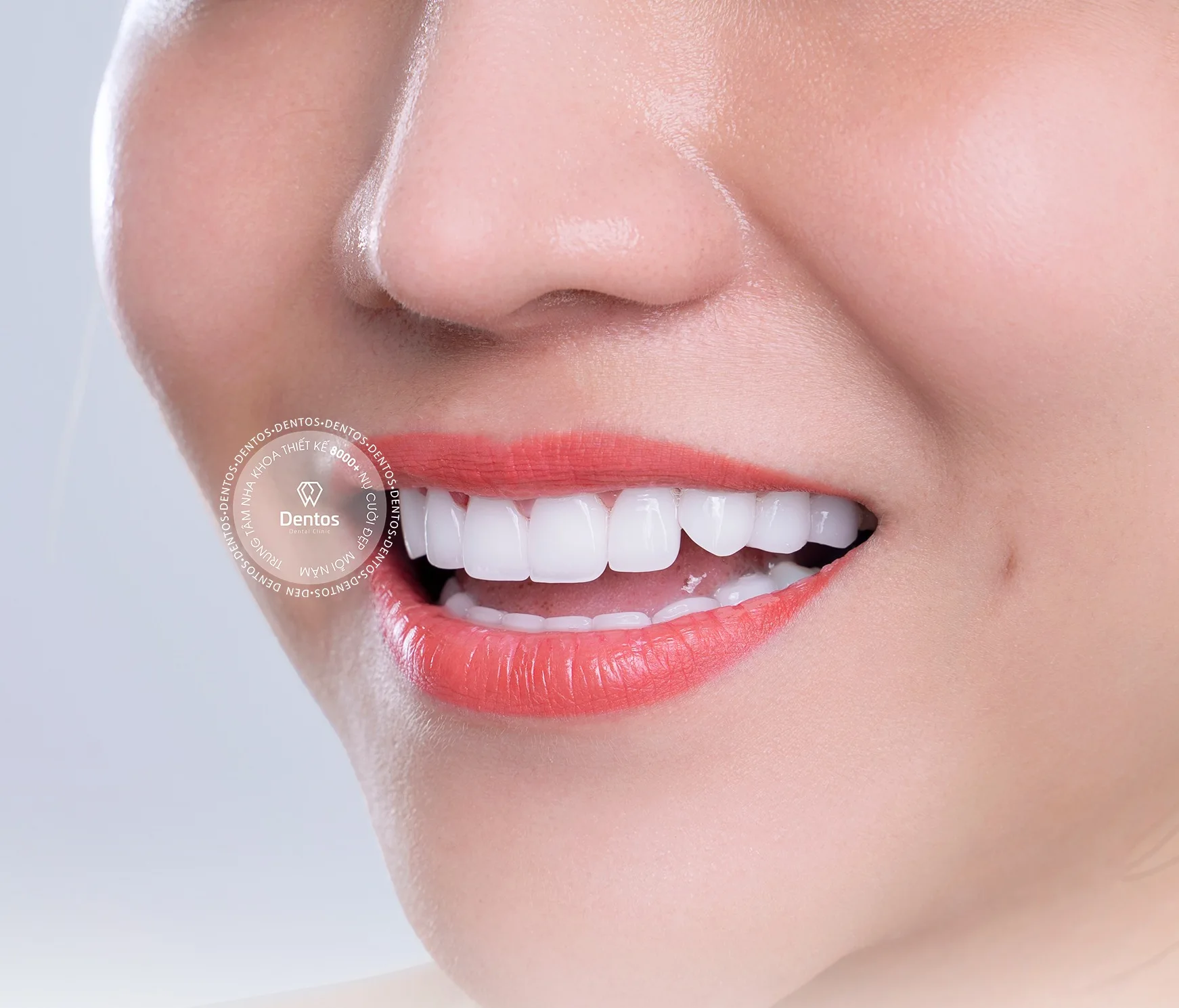 Răng sứ Zirconia giá bao nhiêu? Bọc răng sứ Zirconia có tốt không?
