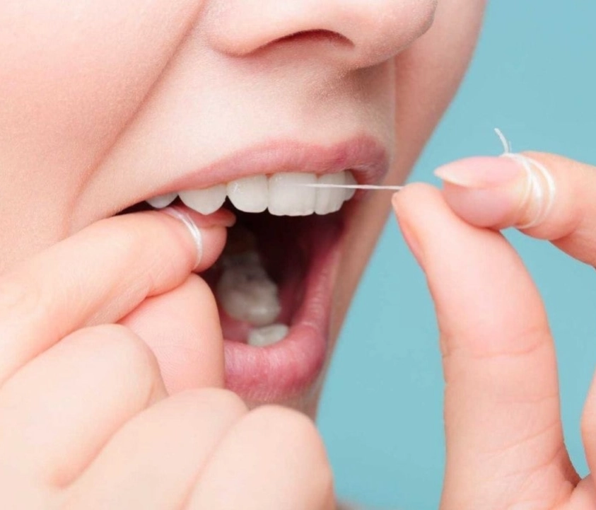 Cách chăm sóc răng sứ: Bí quyết cho nụ cười lấp lánh
