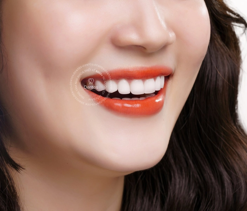 Bọc răng sứ có bền không? Tất tần tật về độ bền của răng sứ